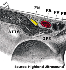 PENG | Nerve Block