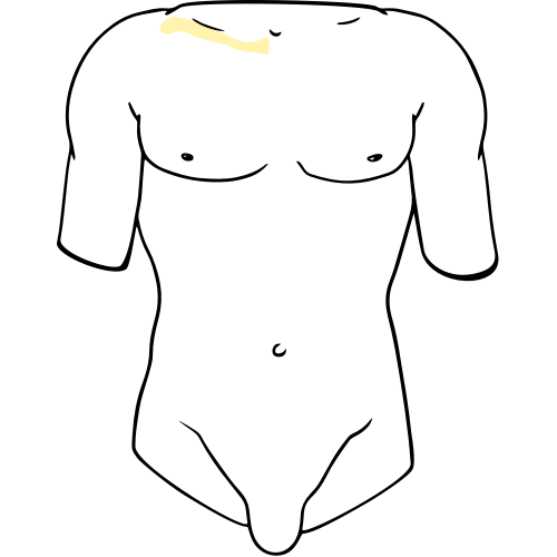 Stylized clavicle graphic representing the clavipectoral fascial plane block.