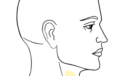 Stellate Ganglion Block